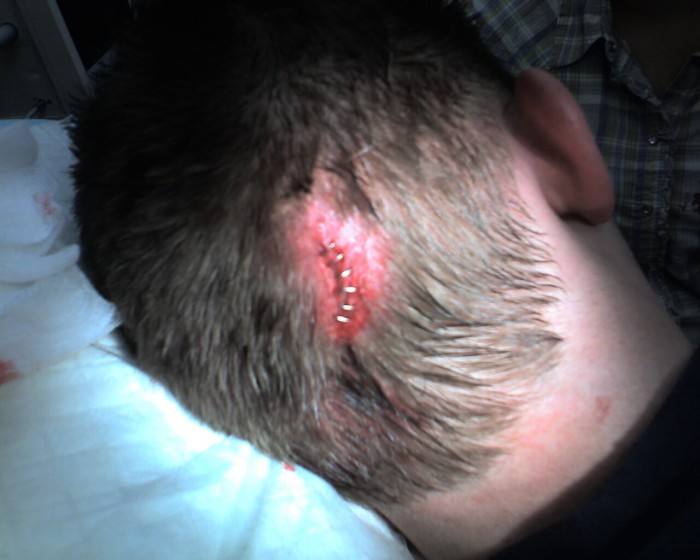 The results of Chad being stupid.